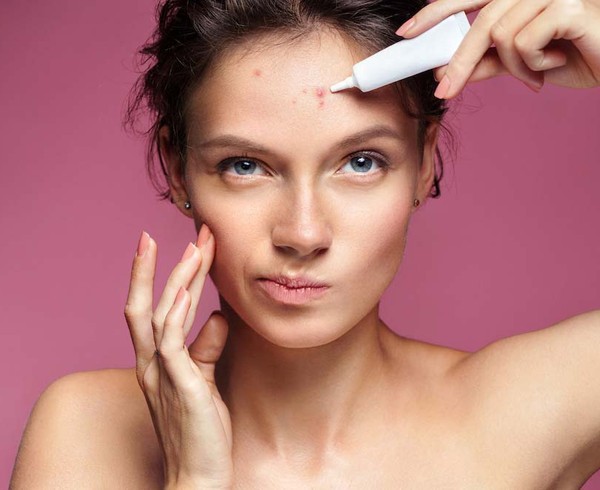 acne scars medications
