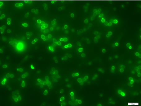 Yeast cells glowing green under a microscope
