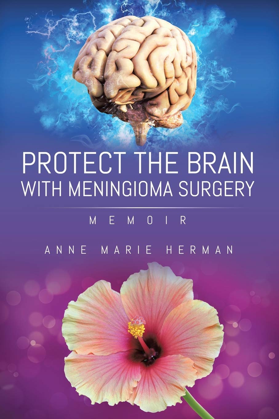 Cover image for Protect the Brain with Meningioma Surgery