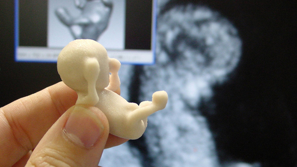 a close-up of view of a plastic resin fetus, in early gestation, held between the thumb and two forefingers of an adult hand.