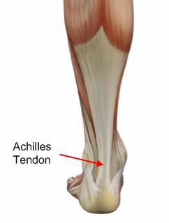 "Plantar