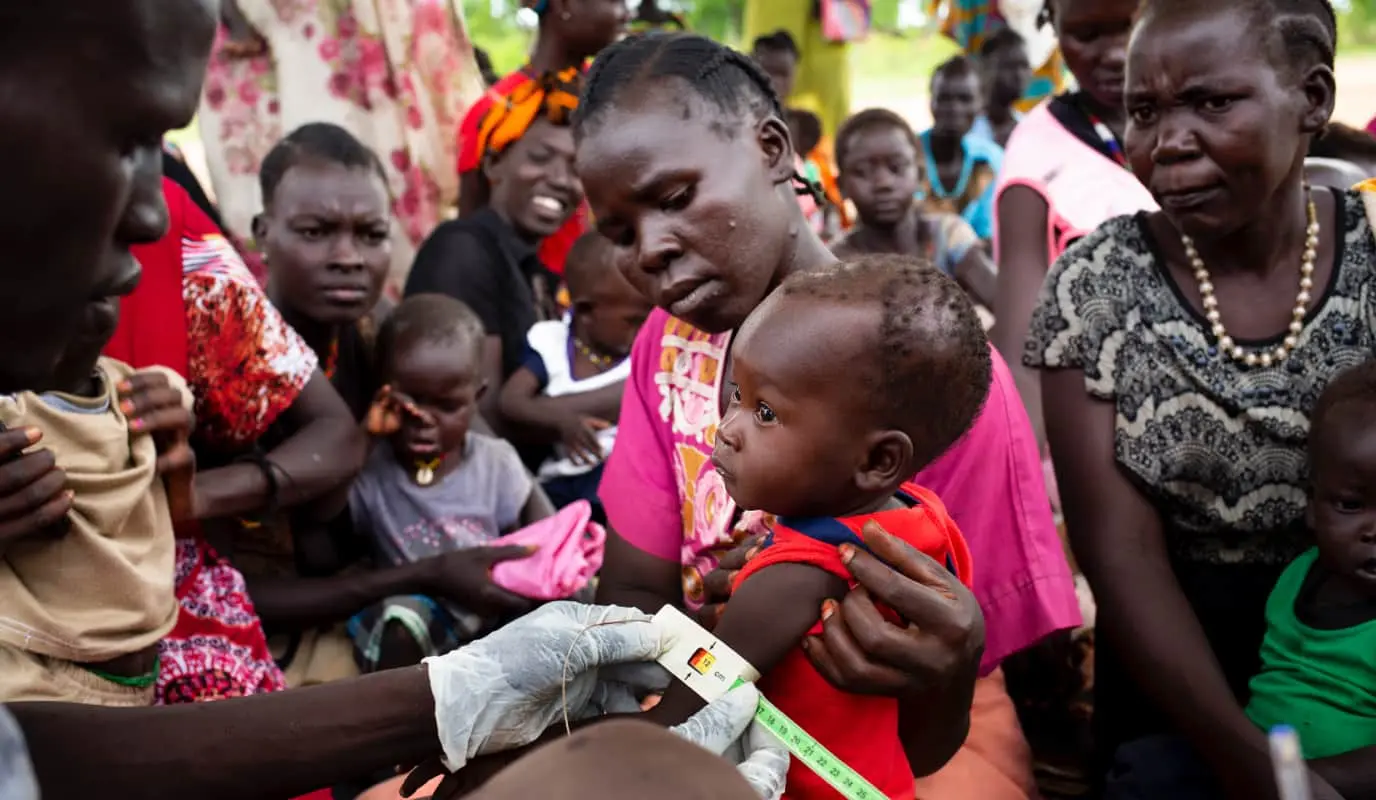 Nutrition clinic in South Sudan