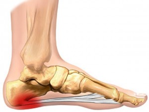 "Plantar