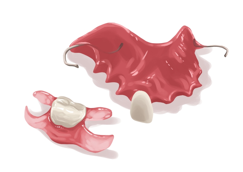 Different types of flipper tooth