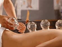 cupping