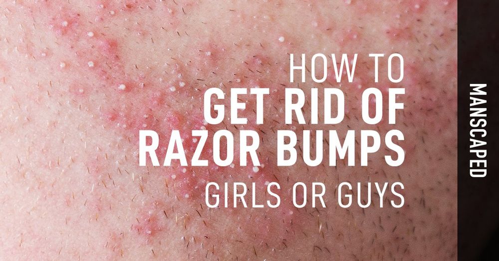 How To Get Rid Of Razor Bumps Girls Or Guys Manscaped™ Blog