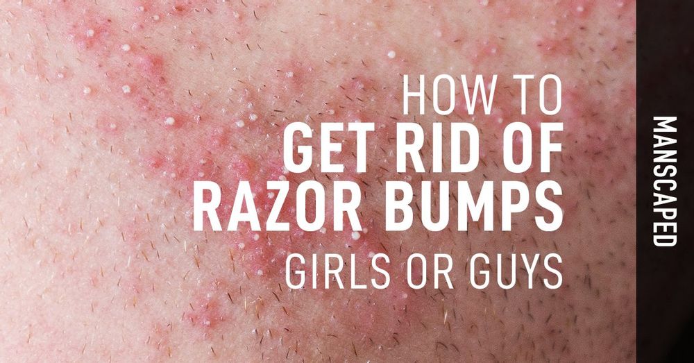 How To Get Rid Of Razor Bumps Girls Or Guys MANSCAPED Blog