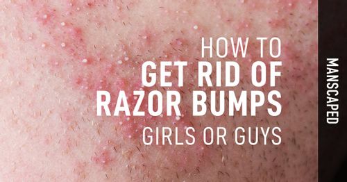 How To Get Rid Of Razor Bumps Girls Or Guys Manscaped™ Blog