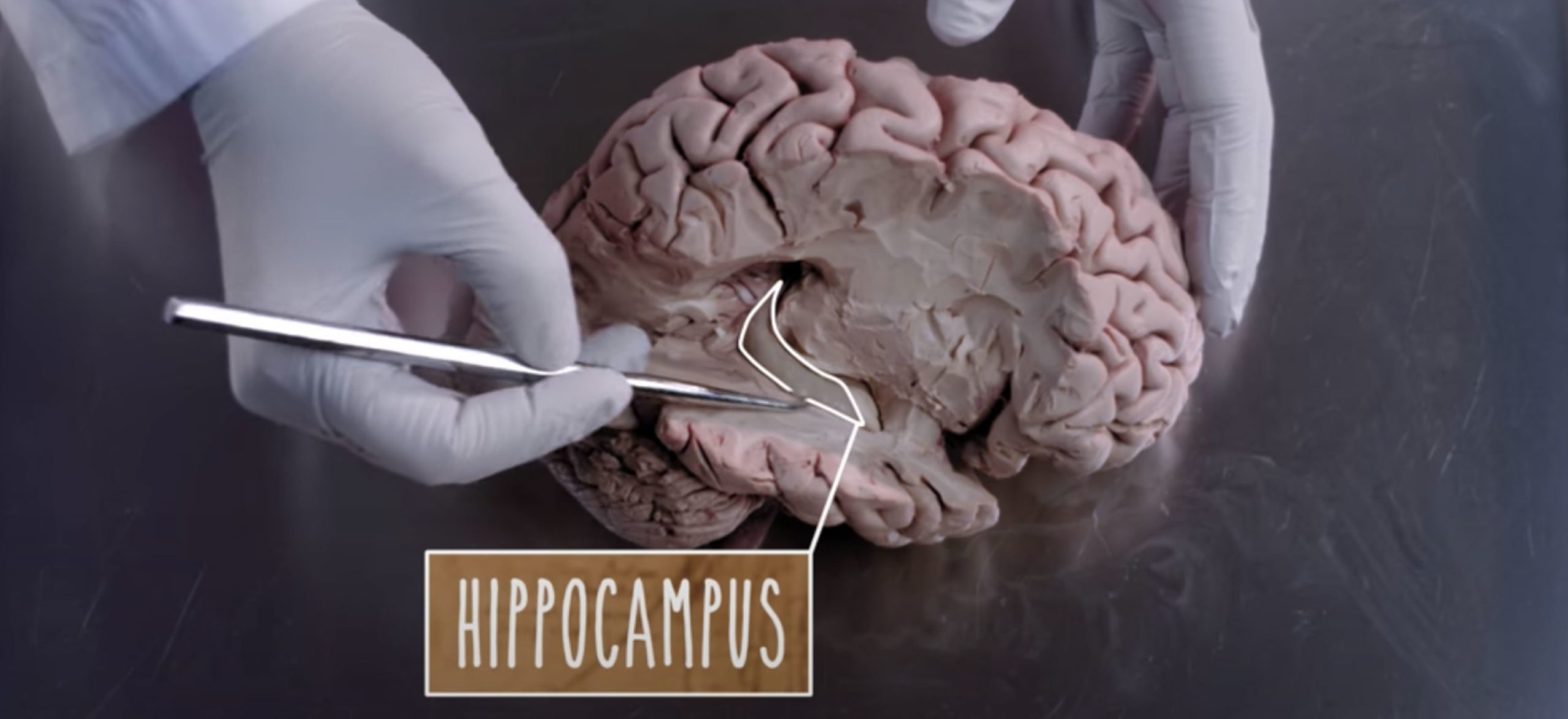 hippocampus anatomy video