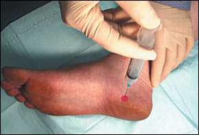 "Plantar