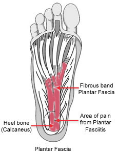 "Plantar