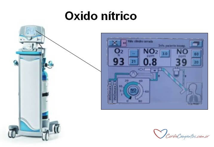 Oxido-nitrico