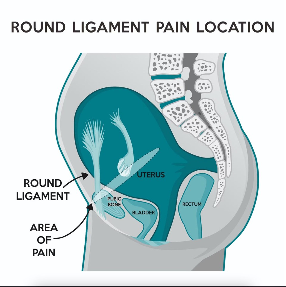 How To Relieve Round Ligament Pain In Pregnancy Experts Explain