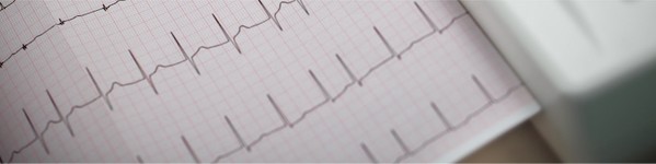 Electrocardiograma | Centrele Ares | Inovatie in Cardiologie