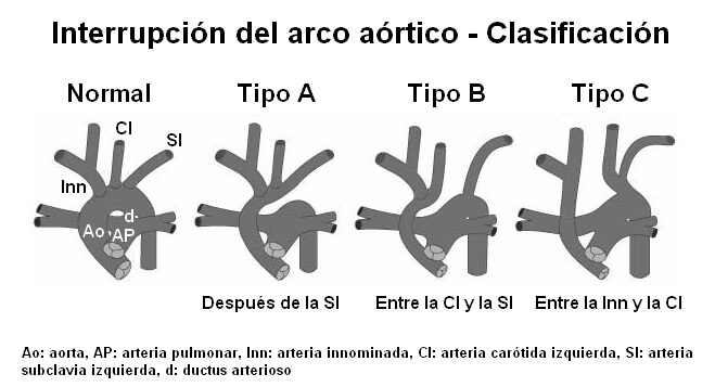 IAA-clasif