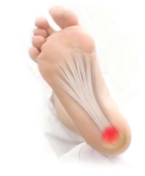 "Plantar