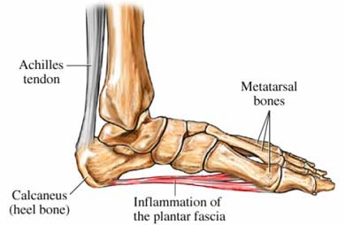 "Plantar