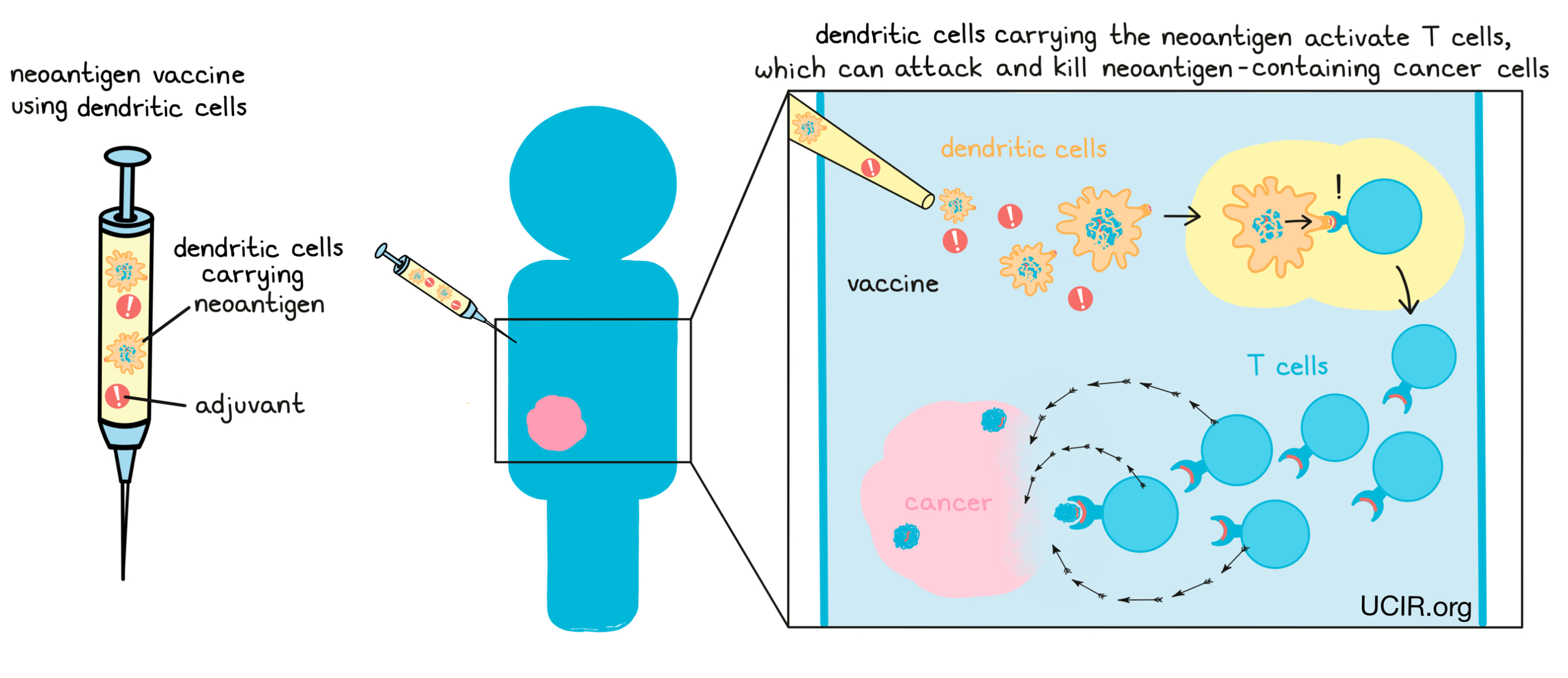 Illustration showing what's in a neoantigen vaccine using dendritic cells