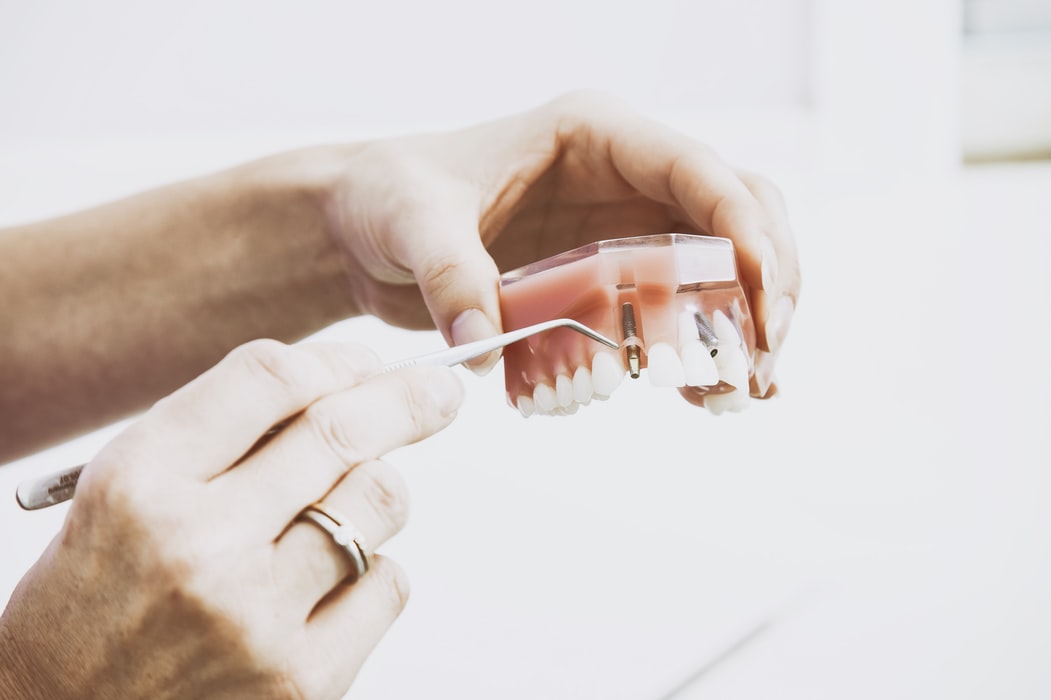 Studio Dentistico Riccardi Lodi - Masticazione e Rimedi