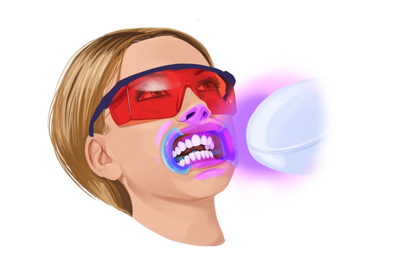 In-office teeth whitening with UV/LED light
