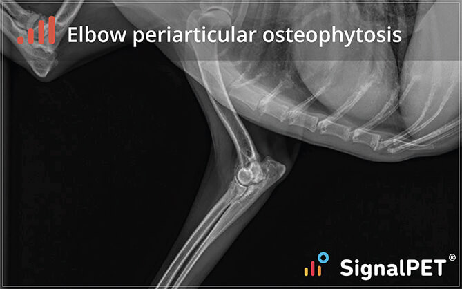 elbow_periarticular_osteophytosis