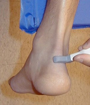 "Plantar