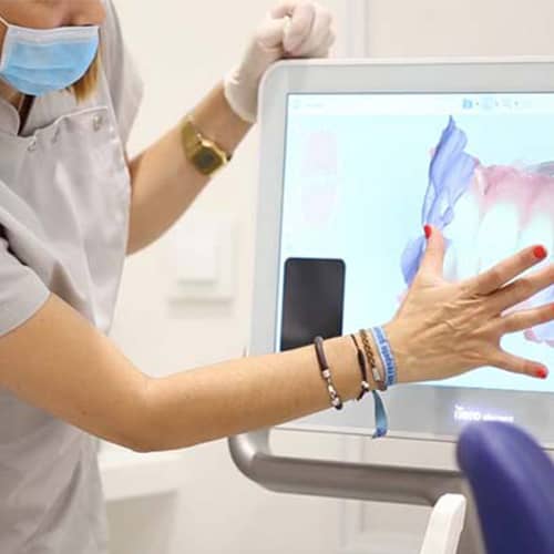 scanner dentaire intra-oral implant dentaire