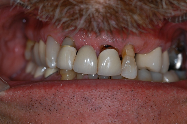 Before