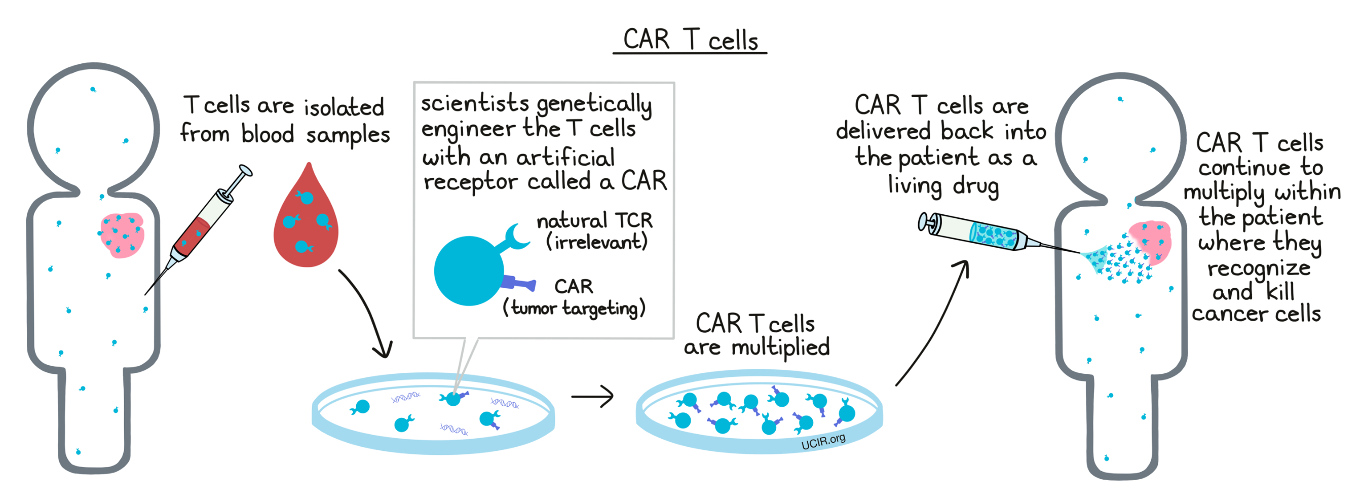 CAR T cells