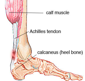 "Plantar