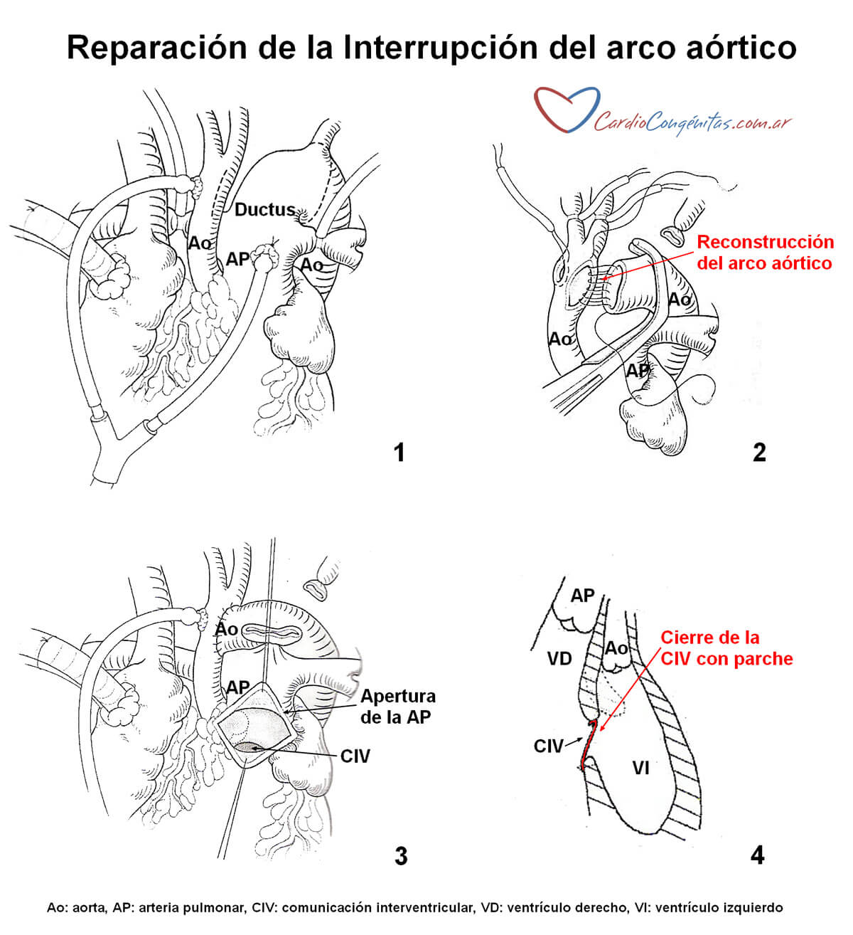 Cirugia-correctora