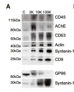 Tetraspanin presence after different centrifugation steps