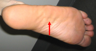 "Plantar