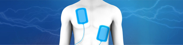 Cardioversia electrică – restabilirea ritmului normal al inimii