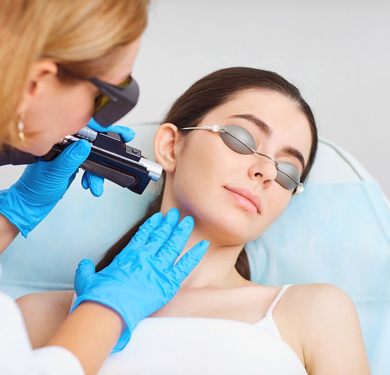 Facial Laser Hair Removal Treatment Greater Toronto Area, Ontario
