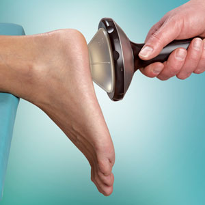 "Plantar
