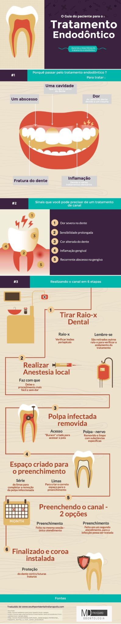 Tratamento de canal - Quando precisamos realizar esse procedimento ...
