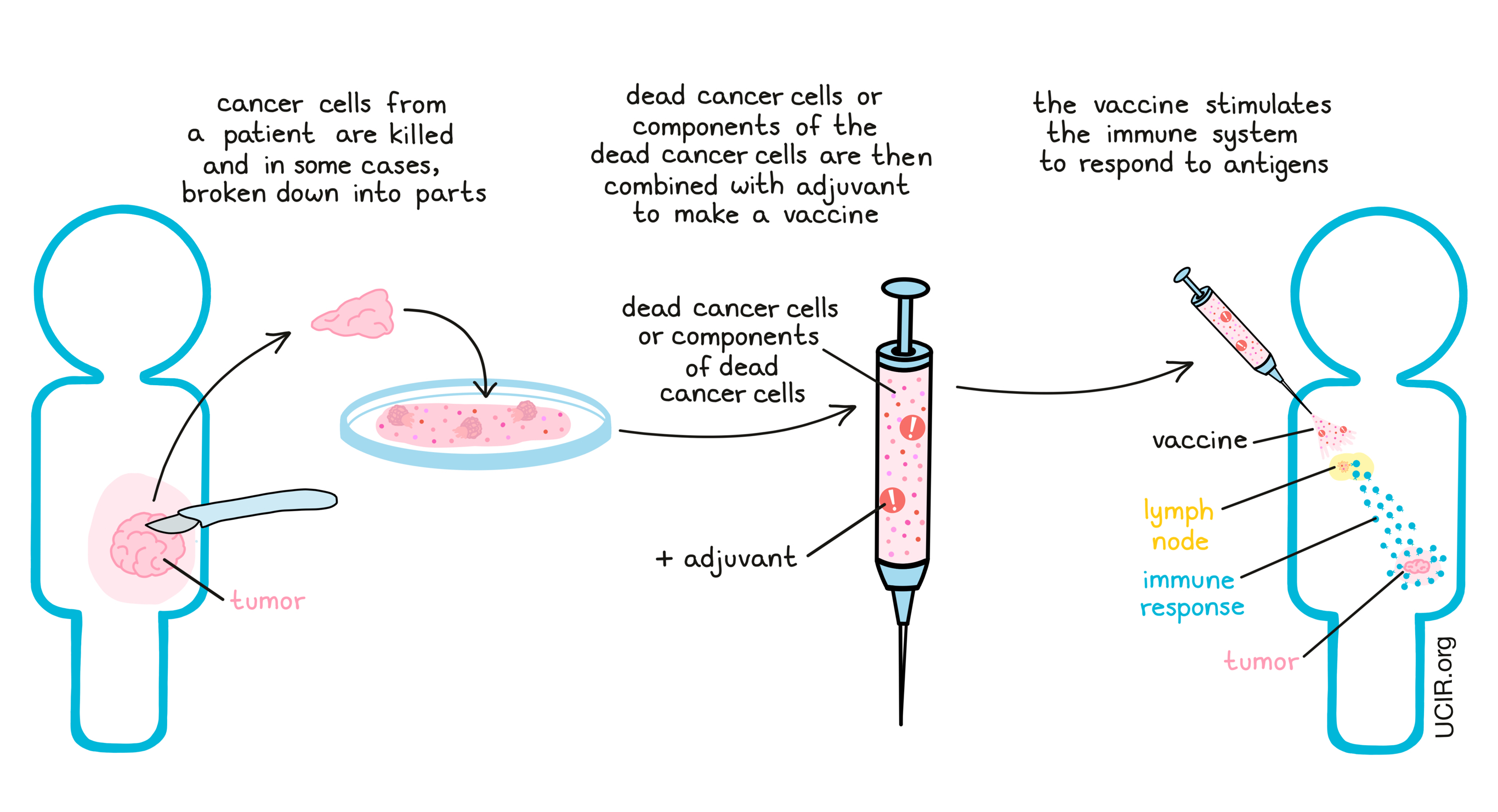 If a tumor can be removed by surgery, it is possible to make a vaccine that includes all of the antigens in the tumor by using samples of the tumor itself