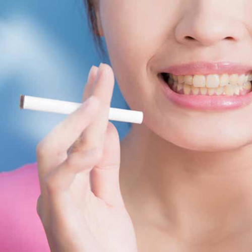 Les risques et danger du tabac sur les implants dentaires