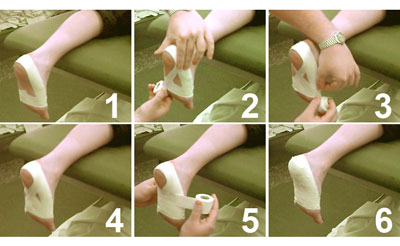 "Plantar