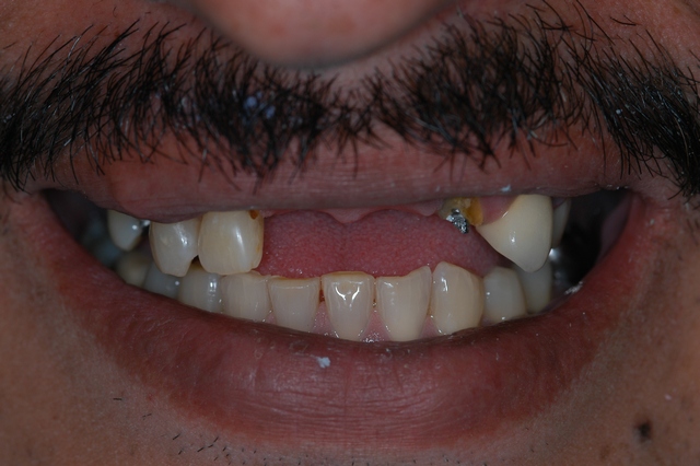 Before