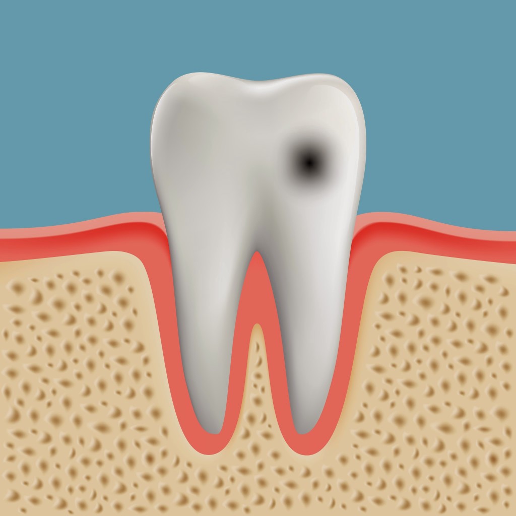 Mancha nos Dentes - Os 5 principais tipos. Veja agora. | MD Odontologia