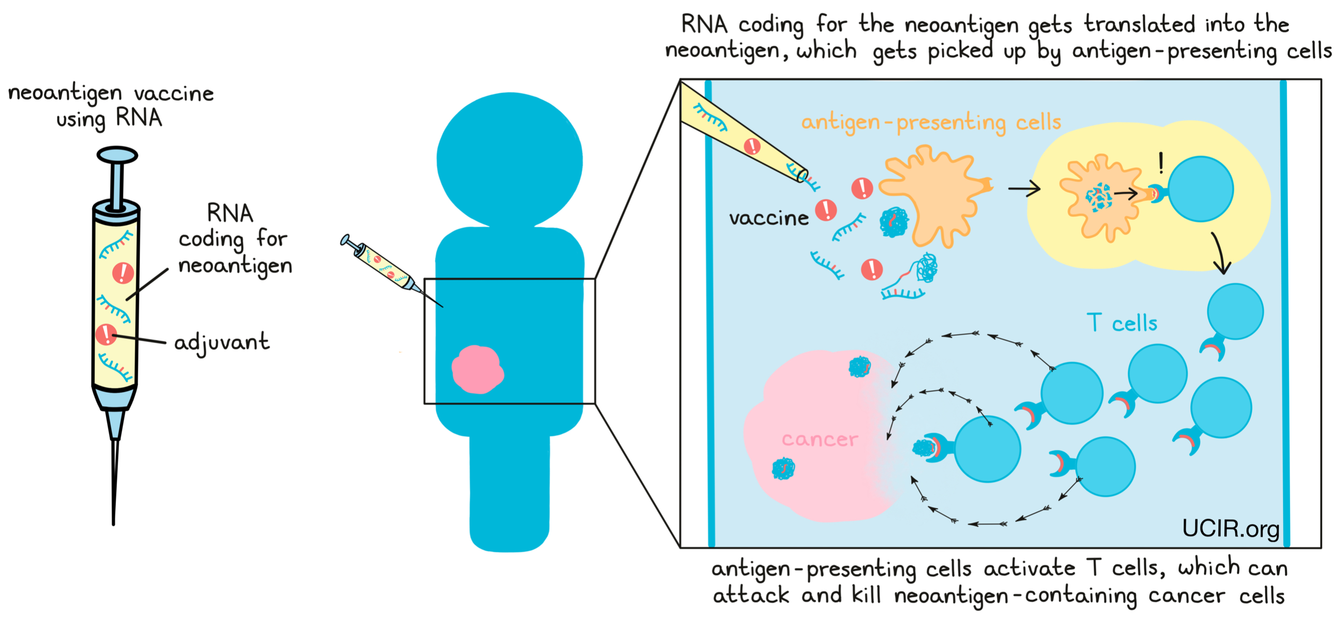 Illustration showing what's in a neoantigen vaccine using RNA