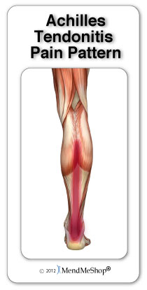 "Plantar