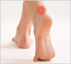 "Plantar