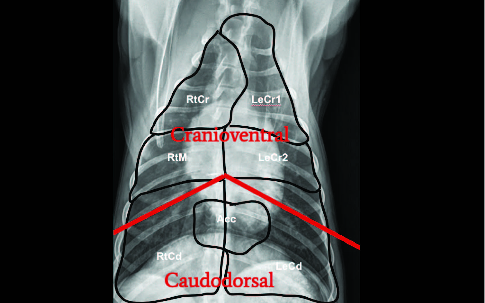 Radiographic distribution of pulmonary patterns