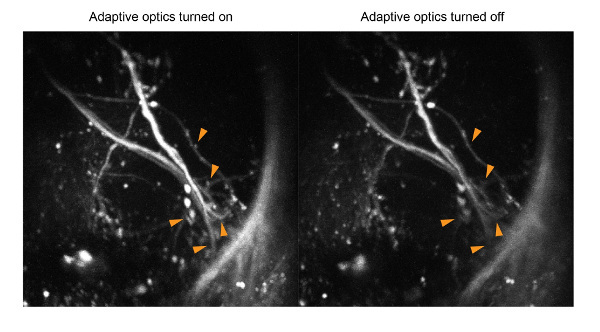 Adaptive optics