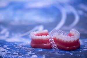 A close-up of two Invisalign trays sitting on top of a set of model teeth at Glenbrook Dental
