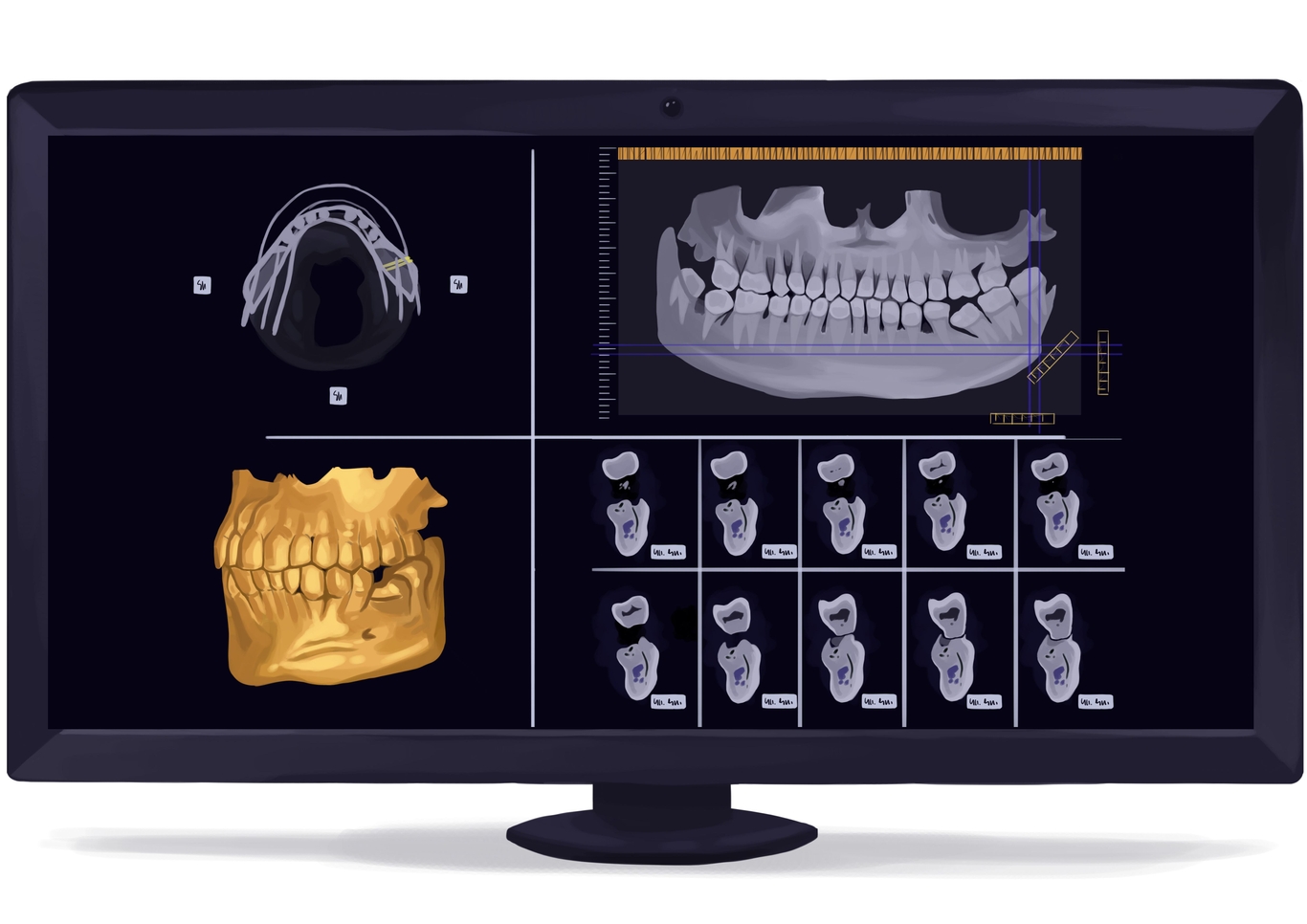 Dental Xray cost, safety, and frequency Authority Dental