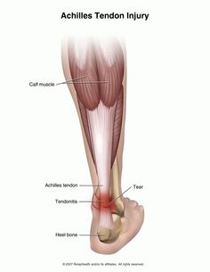 "Plantar